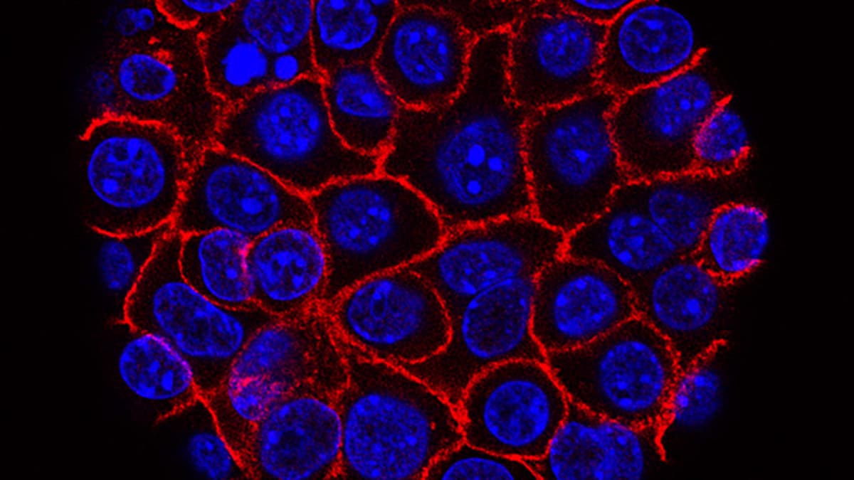 STAT+: ‘Synthetic Lethality’ Could Trigger Another Round of Biotech M&A