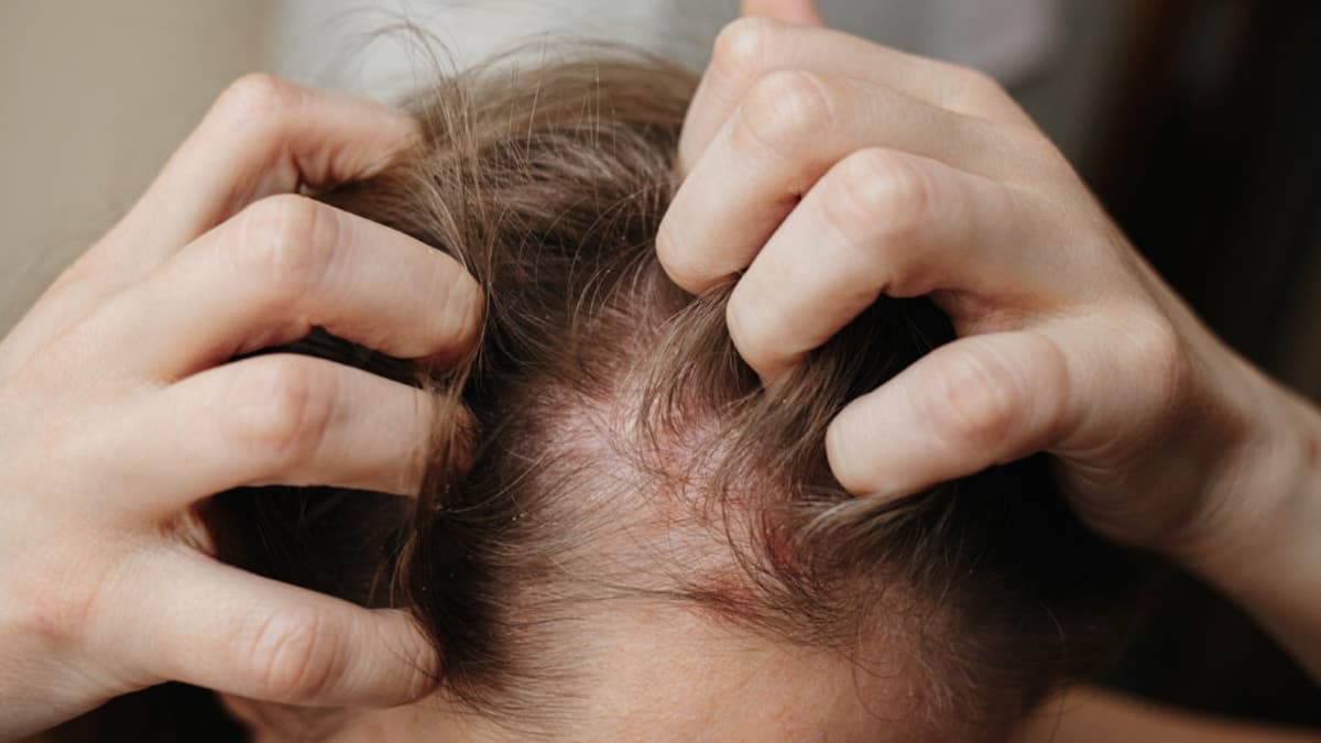 STAT+: Oruka’s Long-Acting Psoriasis Therapy Posts Strong Results in Mid-Stage Study