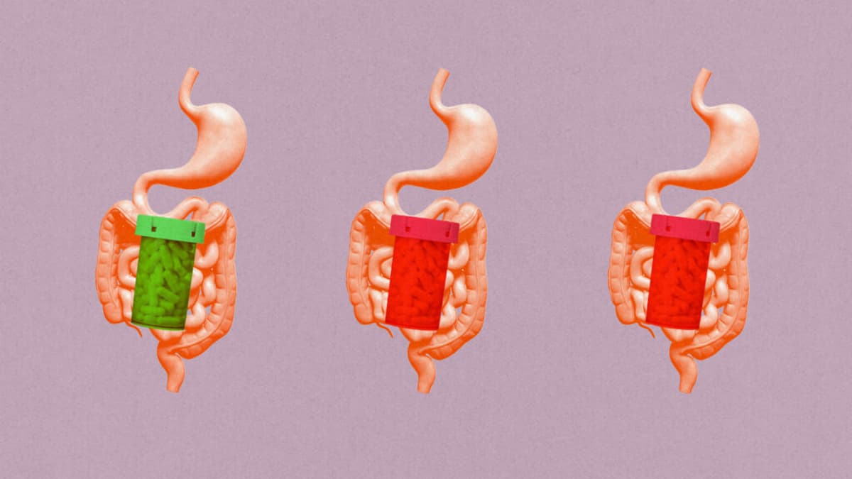 STAT+: New Treatment Approach Could Give IBD Patients Hope, and Be a Bonanza for Drugmakers