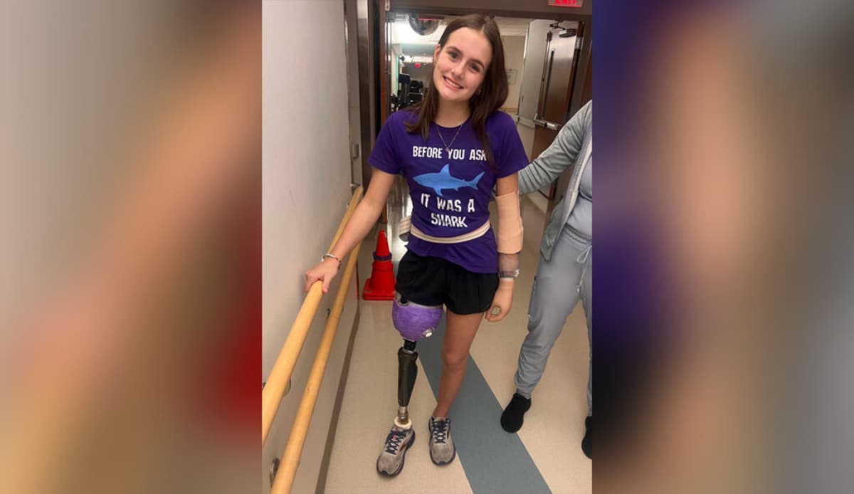 Alabama Launches Shark Alert System Named After Teen Who Lost Hand, Leg in Attack