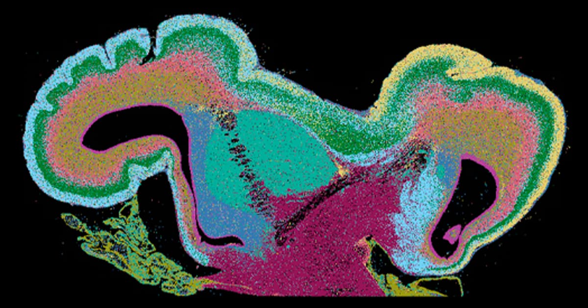 Autism-Linked Genes Expressed in Thalamus Make an Impact, and More