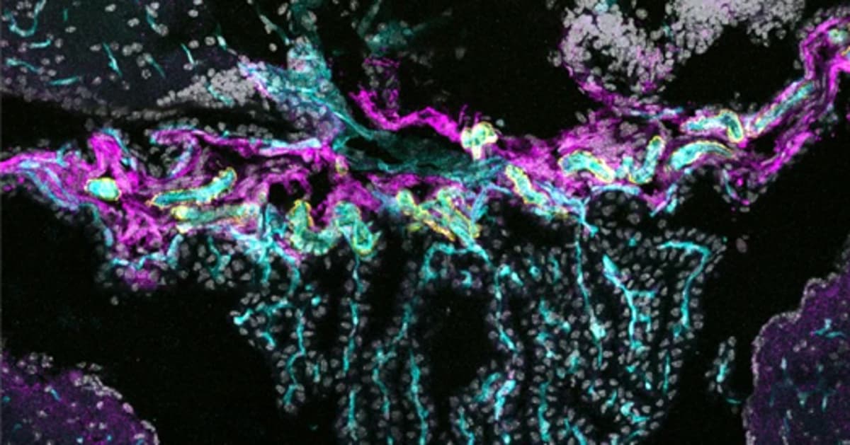Newly Identified Barrier Cells Seal Off Choroid Plexus From CSF, Rest of Brain
