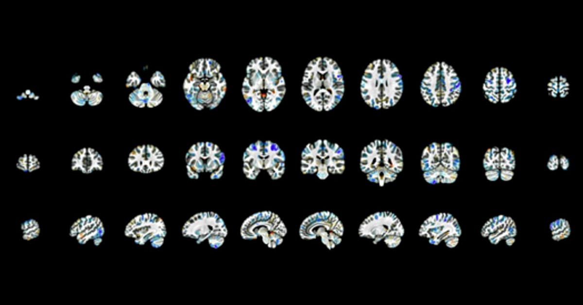 Untangling Genetic Effects, and More