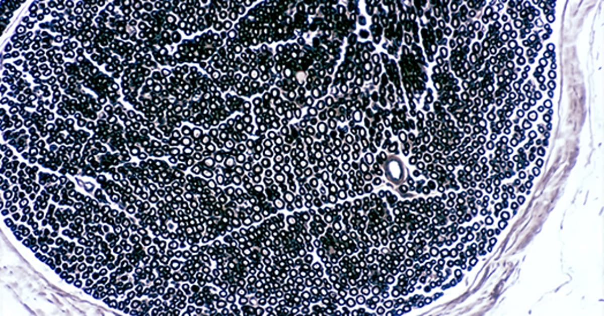Beyond Glucose: The Brain May Feed Itself