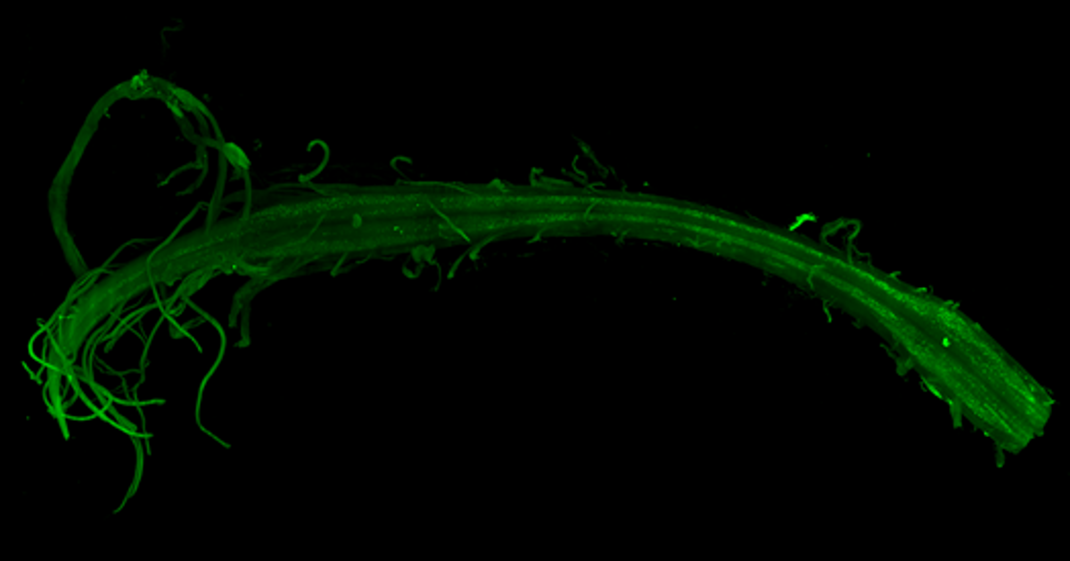 Allen Institute Sets Sights on Treatments for Five Brain Diseases