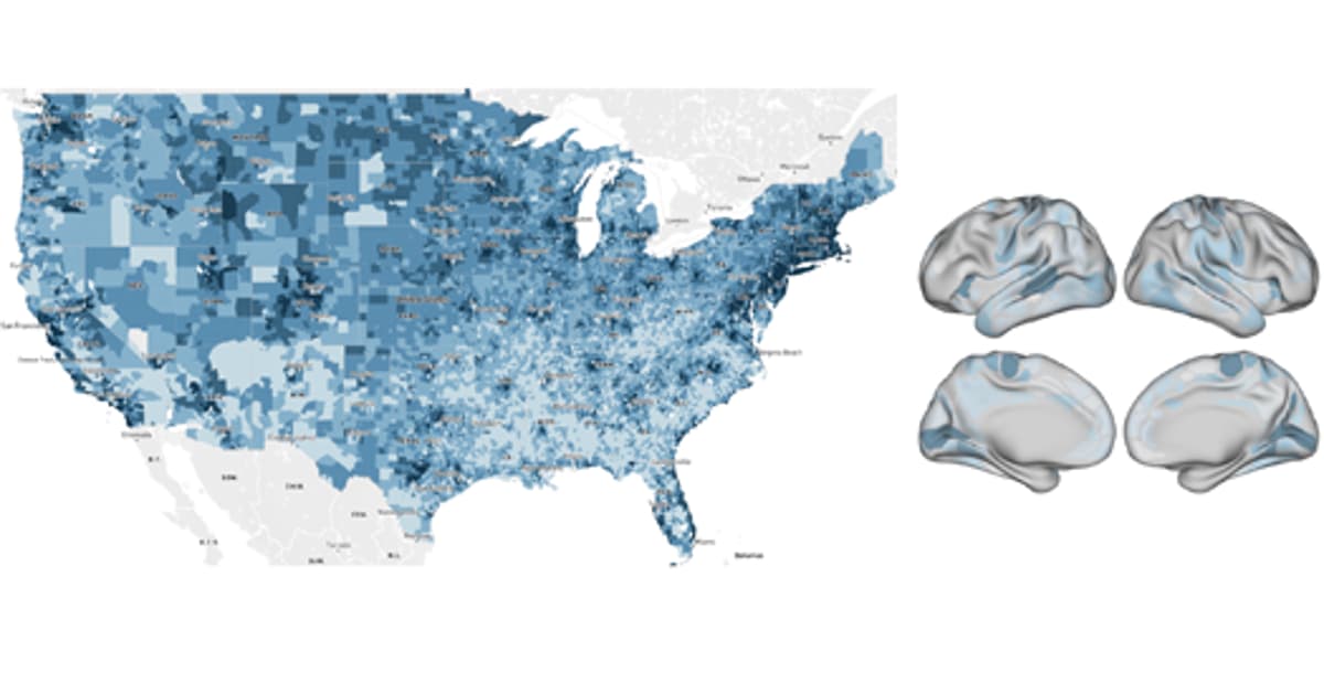 IQ’s Link to Brain Structure, Function in Children May Be a Mirage