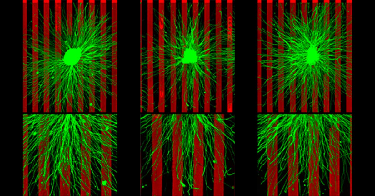 ‘Push-Pull’ Recipe for Neural Wiring Used in Multiple Brain Regions