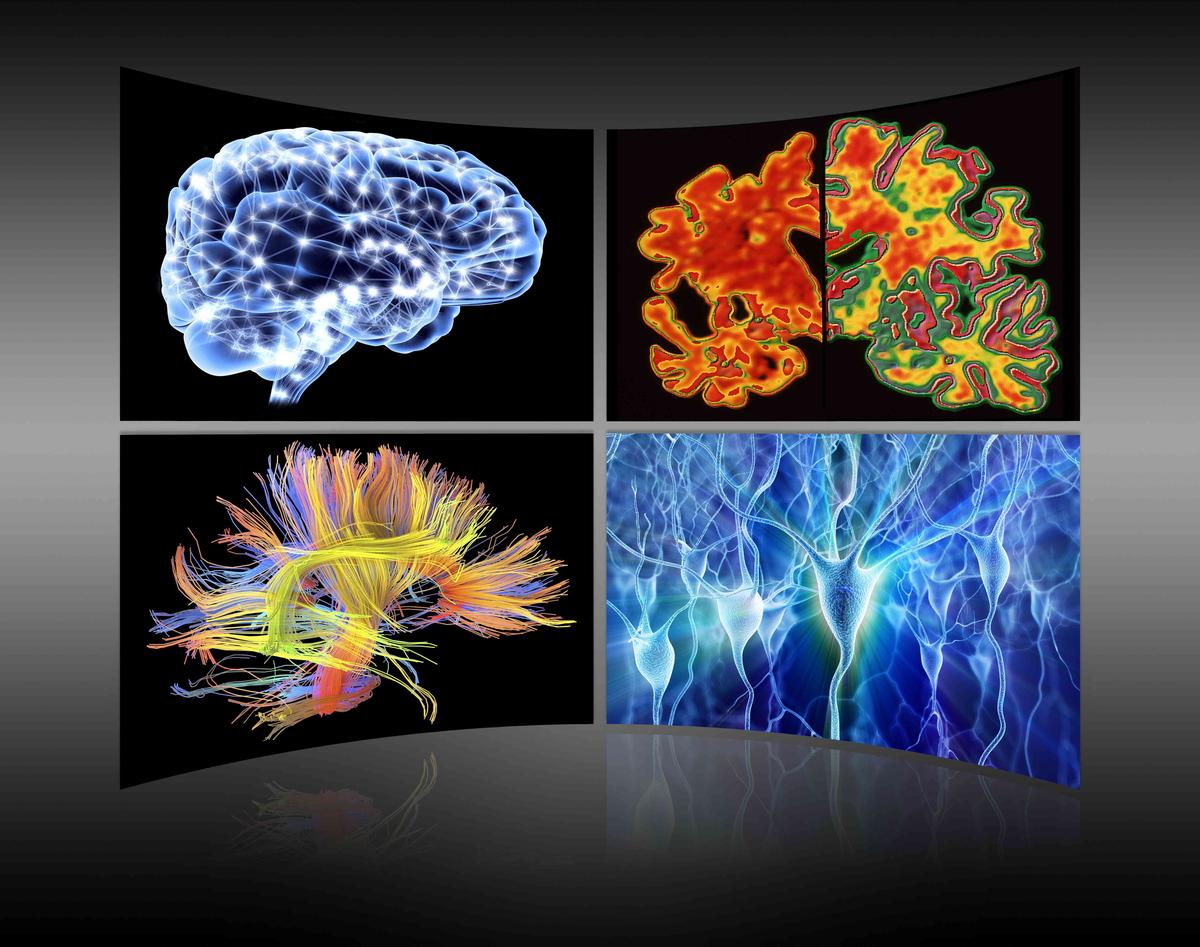 How Does the Nervous System Work With the Endocrine System?