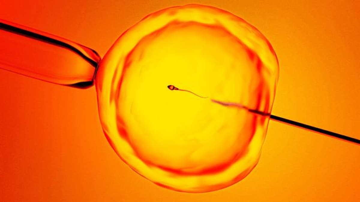 Finding 'Hidden Sperm' In Men Deemed Infertile