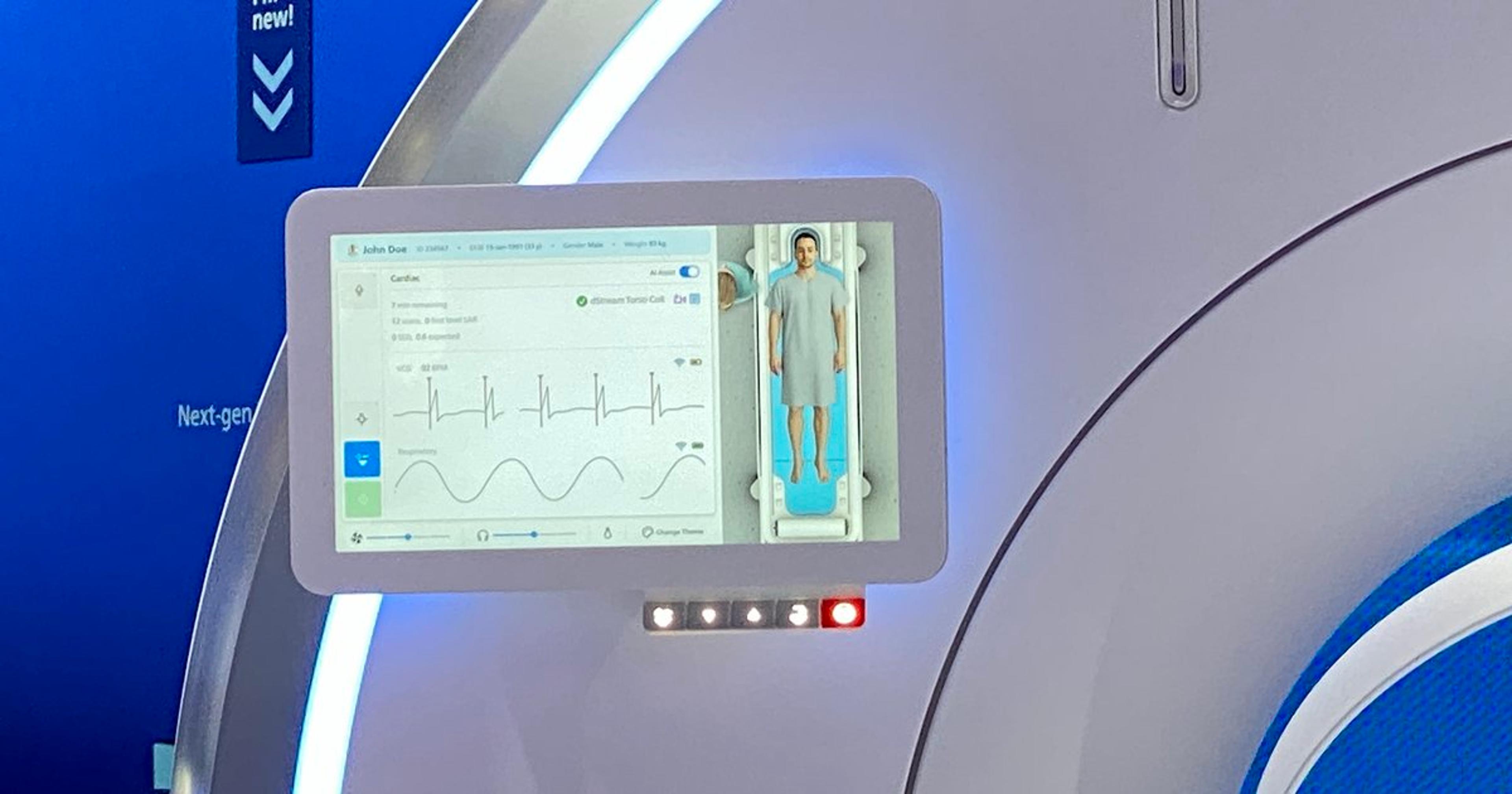 AI-Powered MRI Evaluations Predict STEMI Outcomes Better than Existing Risk Scores