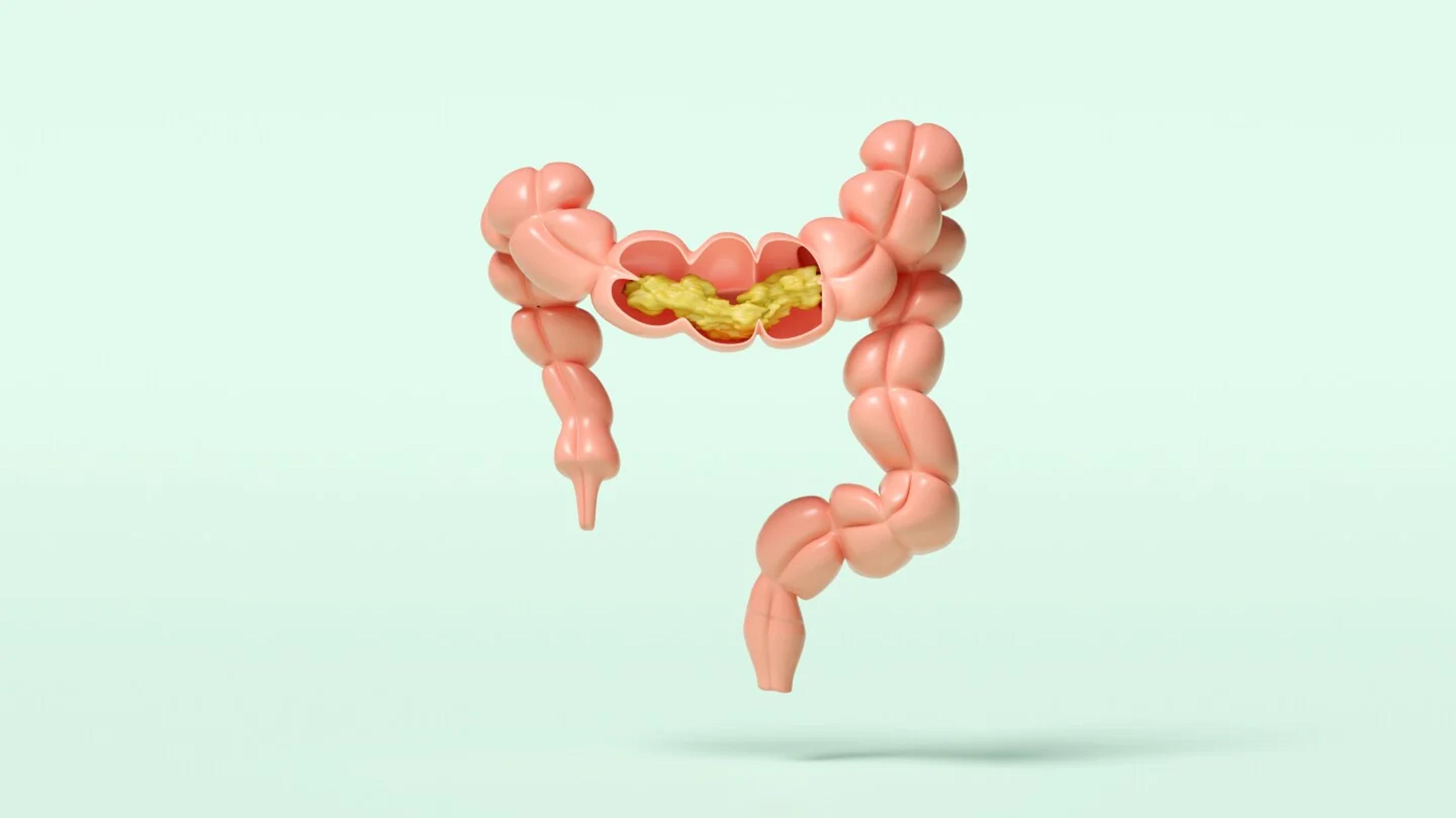 Does Vaxart Hold the Key to the Elusive Norovirus Vaccine?