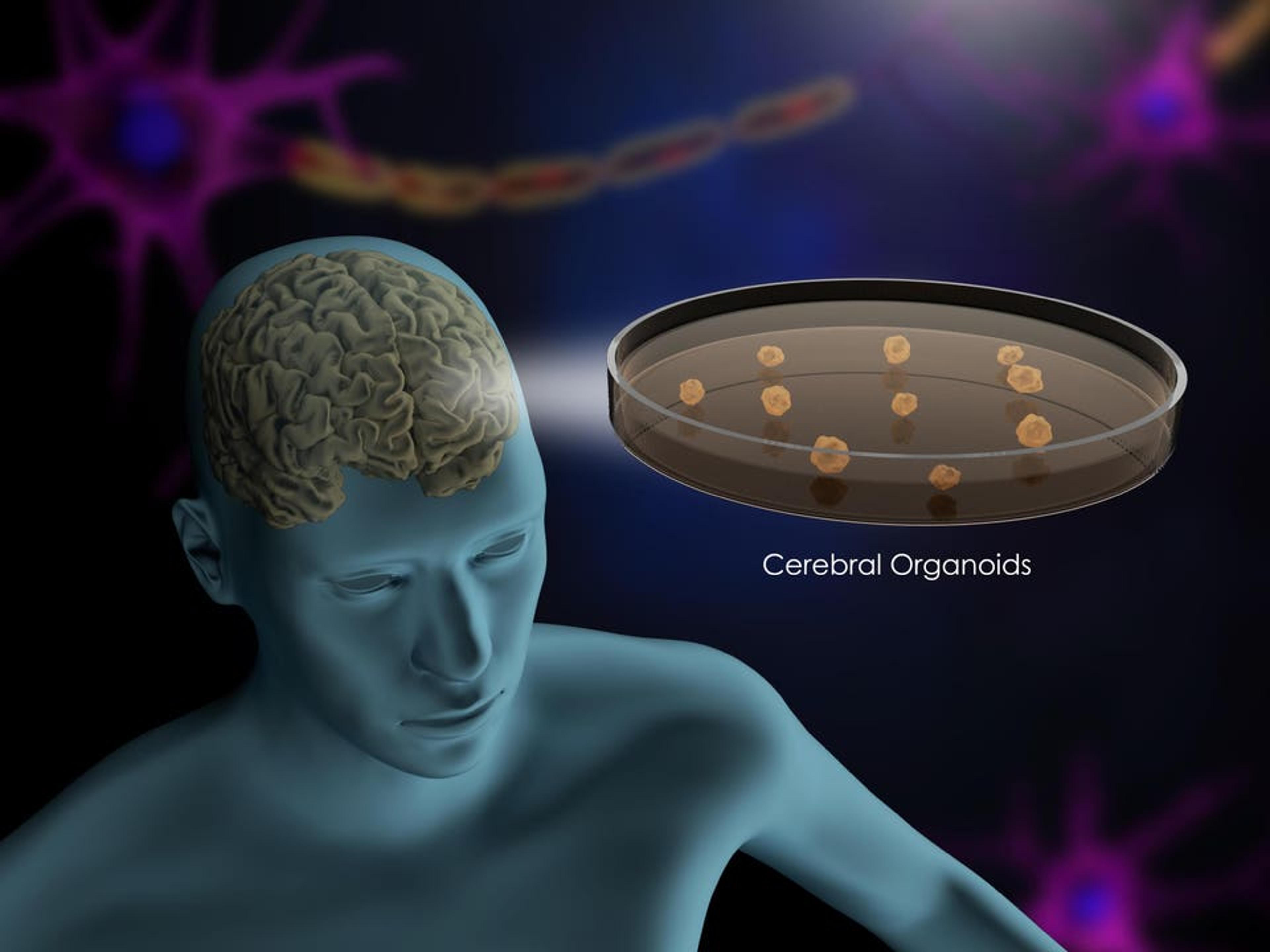 Startup Organotics Fast Tracks Personalized Brain Drug Trials
