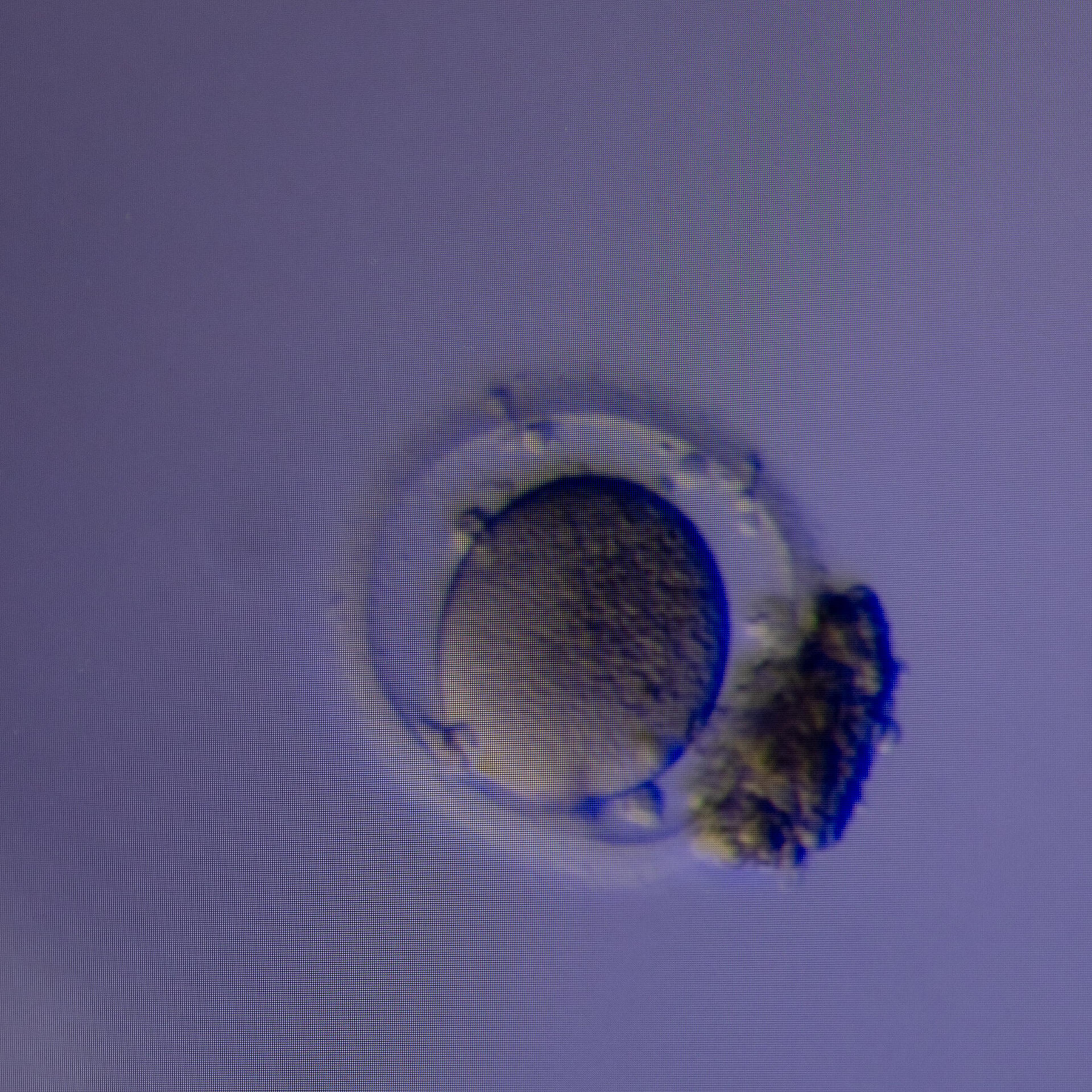 New Method Can Find Hidden Eggs to Aid in Fertility Treatment